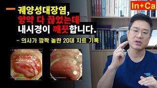 <Entity {'ja': '潰瘍性大腸炎の西洋薬をすべてやめましたが、内視鏡検査の結果はきれいです。医師も驚いた20代の治療記録。', 'ko': '궤양성대장염 양약 다 끊었는데 내시경이 깨끗합니다.  의사가 깜짝 놀란 20대 치료 기록.', 'en': 'I stopped all Western medication for ulcerative colitis, and my endoscopy result is clean. The treatment record of a person in their 20s that shocked the doctor.'}>