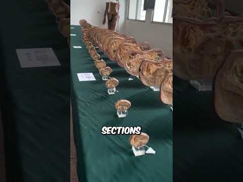 Would You Donate Your Body To Medical Science?