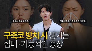 구축코 방치 시 생기는 심미 ·기능적인 증상 | 늑떼선생김현주