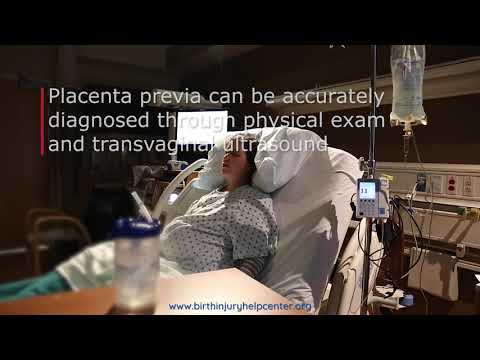 Placenta Previa