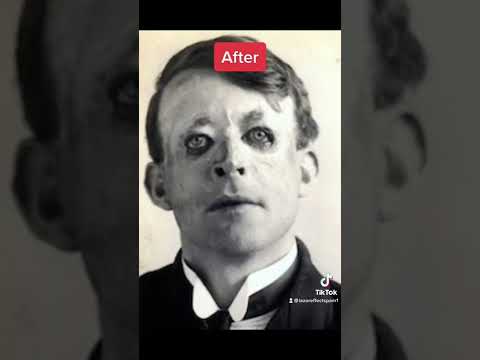 World War Soldiers Before And After 🪖 #shorts