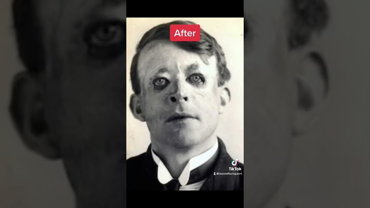 World War Soldiers Before And After 🪖 #shorts