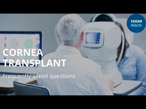 Cornea transplant- Frequently Asked Questions