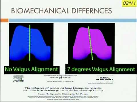 Biomechanics of Knee and its implication in Total Knee Arthroplasty