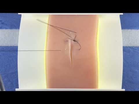 Vertical Mattress Suture Tutorial