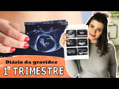 Nausea, bleeding, and insecurity - PREGNANCY DIARY: FIRST TRIMESTER | PMS by Ju Ferraz
