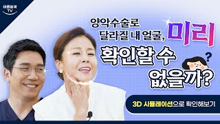양악 수술 아래턱만 하면 안 되는 이유