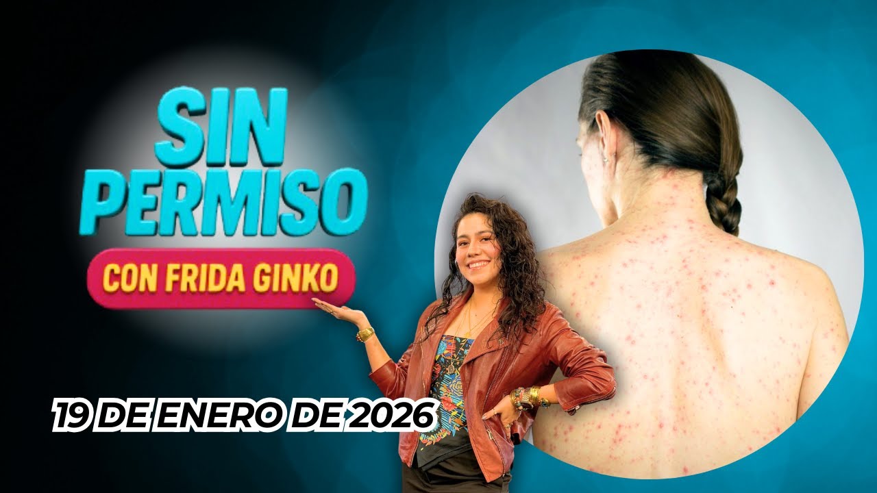 #SinPermiso con Frida Ginko: Regresó el Sarampión