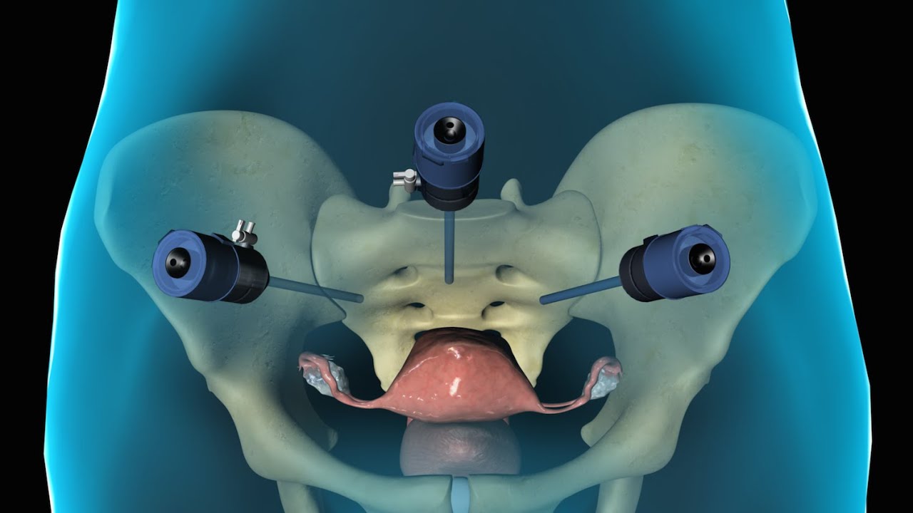 Luis Abraham Zúñiga Vázquez-9