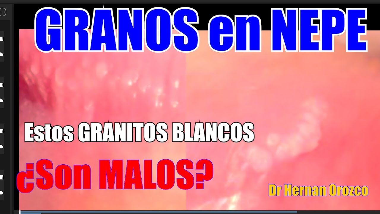 Hernán Orozco Martínez-24