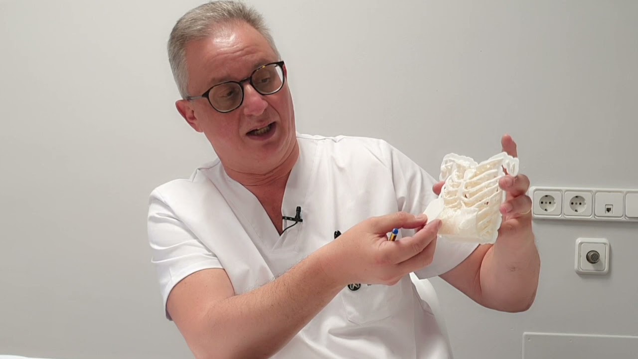 Miniatura de Cirugía Torácica Mínimamente Invasiva