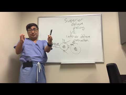 Superior Oblique Palsy versus Inferior Oblique Overaction