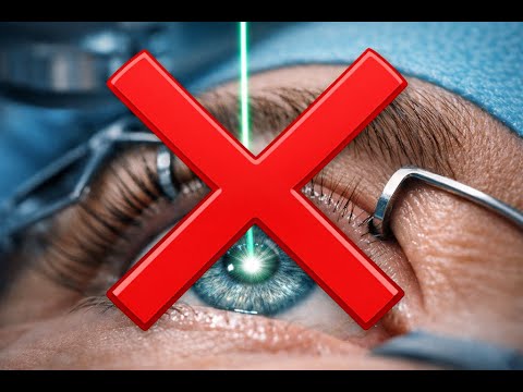 Augenlaser Erfahrung