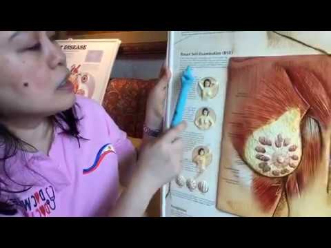 Kung ito ay posible upang breastfeed na may implants Ang pinakamaliit na laki ng mga suso