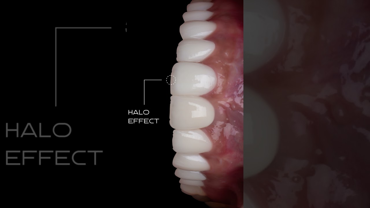 Full motion dental case video example three