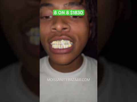 8 on 8 VVS Moissanite Grillz on 925 Silver & Yellow Gold Plating | MOISSANITEBAZAAR.COM