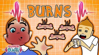 Operation Ouch - Burns &amp; Skin Grafts | Human Skin