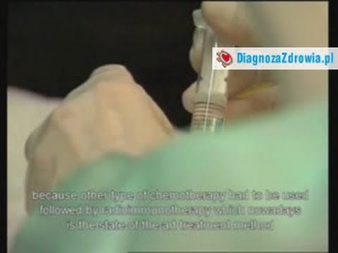 Hammer chirurgia toe deformacja Brązowe szorstkie plamy na kościach palców