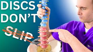 Slipped Disc Explained: What It Really Means
