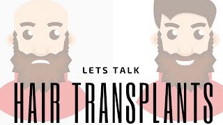 Hair Replacement Hair System Review Lets talk TRANSPLANTS!