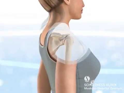 «Die Anatomie der Schulter» - Schulthess Klinik