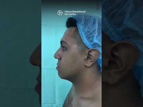 Clínica Maxilofacial del Caribe  image-gallery-testimonios