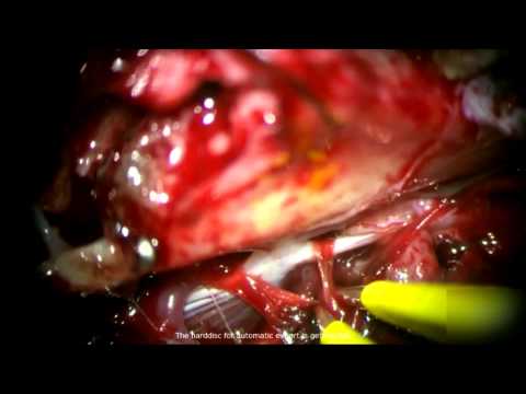 download lagu mp3 mp4 Micro Temporal Infundibula, download mp3 Micro Temporal Infundibula free download, download mp3 Micro Temporal Infundibula