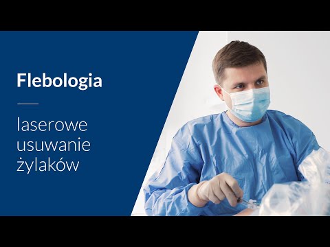 Laserowe usuwanie żylaków (EVLT, skleroterapia)