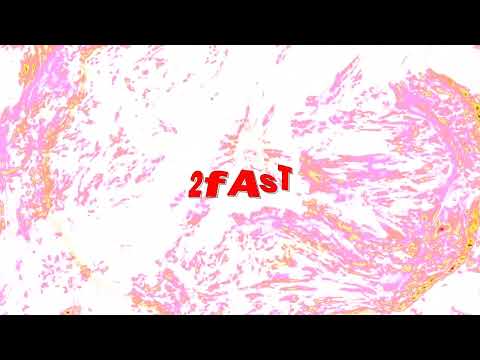 (FREE) NO MELODY X AFOURTEEN X NASCAR ALOE TYPE BEAT "2fAsT"