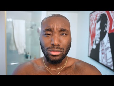 My Hairline Surgery WENT COMPLETELY WRONG...