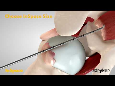 Stryker InSpace Short Animation