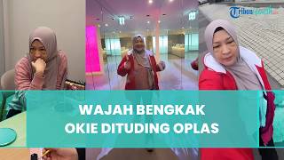 Wajah Bengkak hingga Ada Benjolan di Bawah Mata, Okie Agustina Dituding Lakukan Operasi Plastik