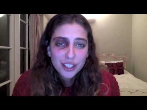 How to: Cover Up Black Eyes & Bruising