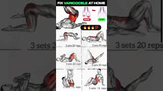 Download lagu Fix Your Varicoceles Naturally | Daily Pelvic & Leg Workout 💪🩺#shorts #workout #kegelworkout mp3 Download lagu Fix Your Varicoceles Naturally | Daily Pelvic & Leg Workout 💪🩺#shorts #workout #kegelworkout mp3