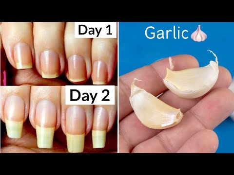 How to Grow Nails in 2 Days || How to Grow Nails Fast || 