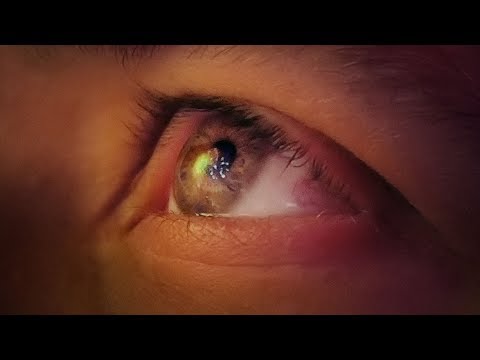 Video thumbnail for Statusbericht 2018