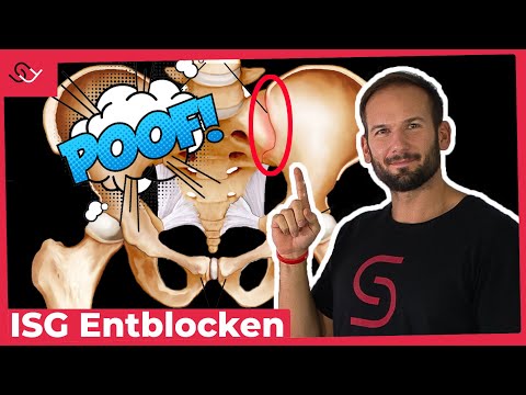 ISG Blockade lösen - Mach diese einfache Übung