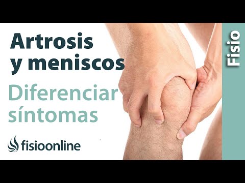 Csípőízület osteoarthritis kezelése 4 fokkal