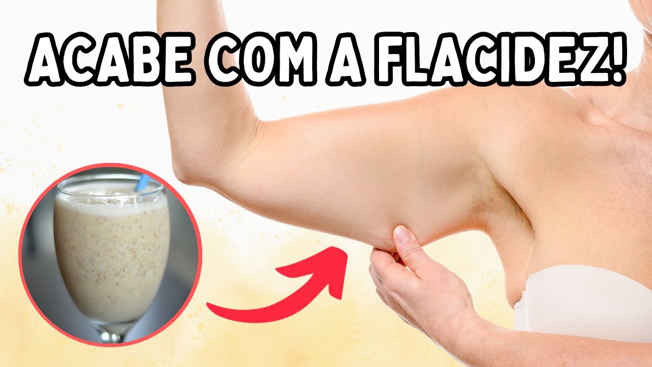 QUAL O MELHOR COLÁGENO PARA FLACIDEZ? | Dr Dayan Siebra