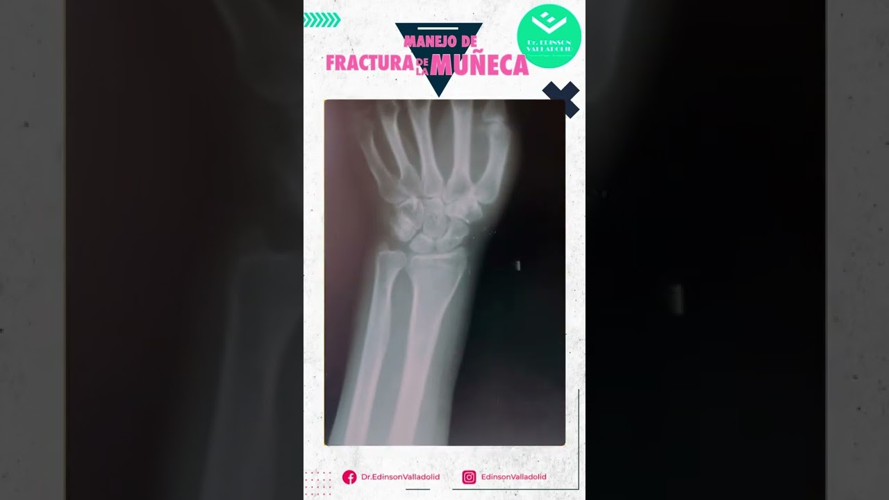 Edinson Valladolid Purizaga-24