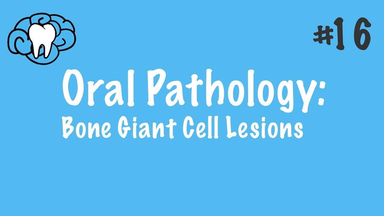 Oral Pathology | Giant Cell Lesions | INBDE, ADAT