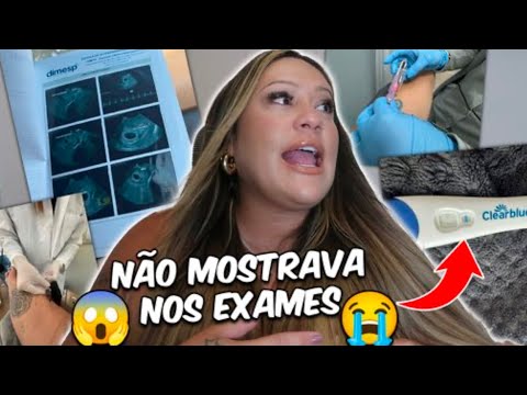 RELATO DE COMO DESCOBRI MINHA GRAVIDEZ
