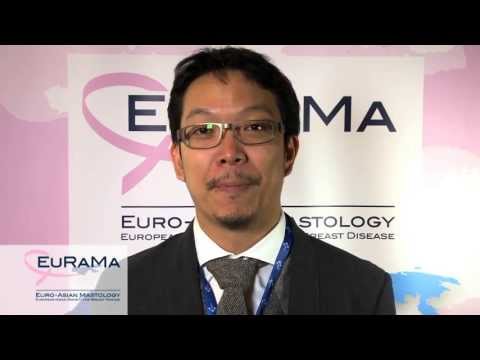 การเสริมเต้านม Eurosilicone หน้าอกเล็กจีน