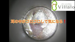 耳掃除動画vol.54「耳の中がゴロゴロして気になる!」