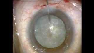 SICS with HCP manual