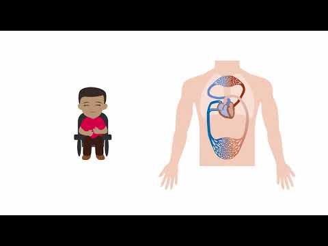 Managing mixed shock states