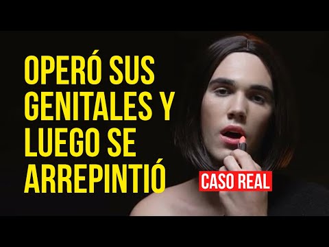 De Sueño a PESADILLA 😱 Cambió de SEXO y LO PERDIÓ TODO 💔 El IMPACTANTE caso de Walt Heyer