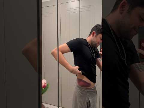 MERDİVENDEN DÜŞTÜM - DÜNYANIN EN BÜYÜK MORLUĞU