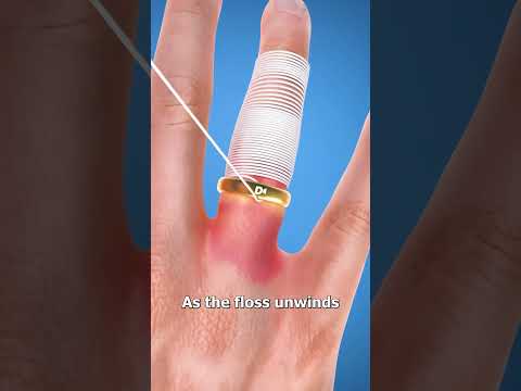 How To Get A Stuck Ring Off 🤔