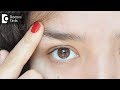 Swollen Eye From Pimple On Eyebrow